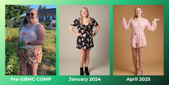 Emily's weight loss progress shown in three images