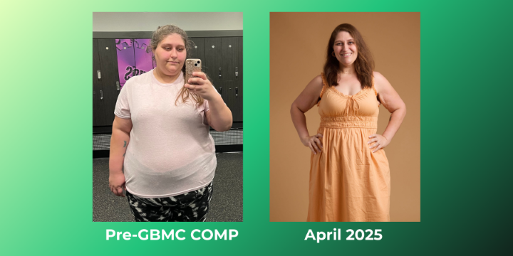Nicole's weight loss progress in two photos