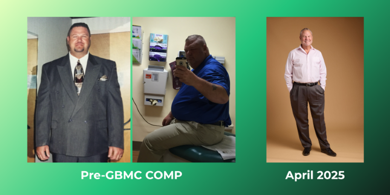Joe's progress before and after weight loss surgery