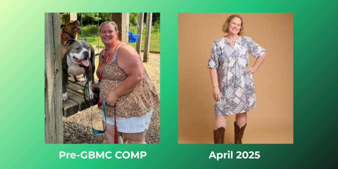 Lindsay's before and after weight loss surgery photos