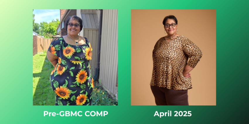 Michelle's before and after weight loss surgery photos