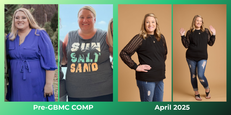 Terri shows off her progress after weight loss surgery