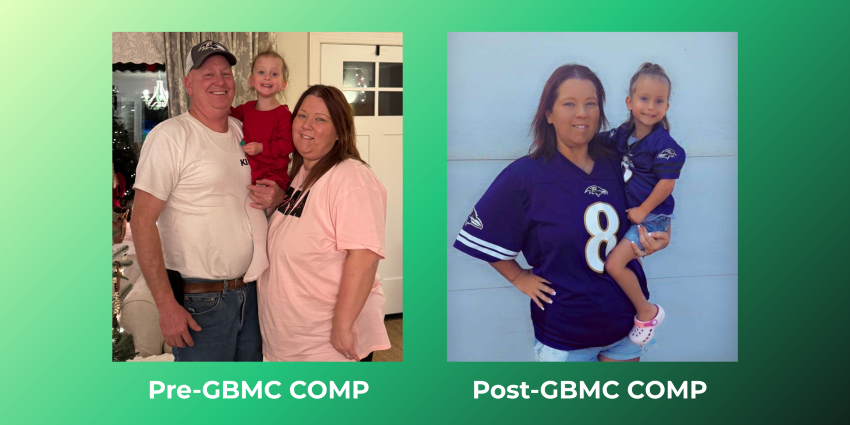 Ashley's before and after surgical weight loss photos