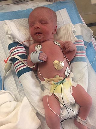 Liam in the NICU