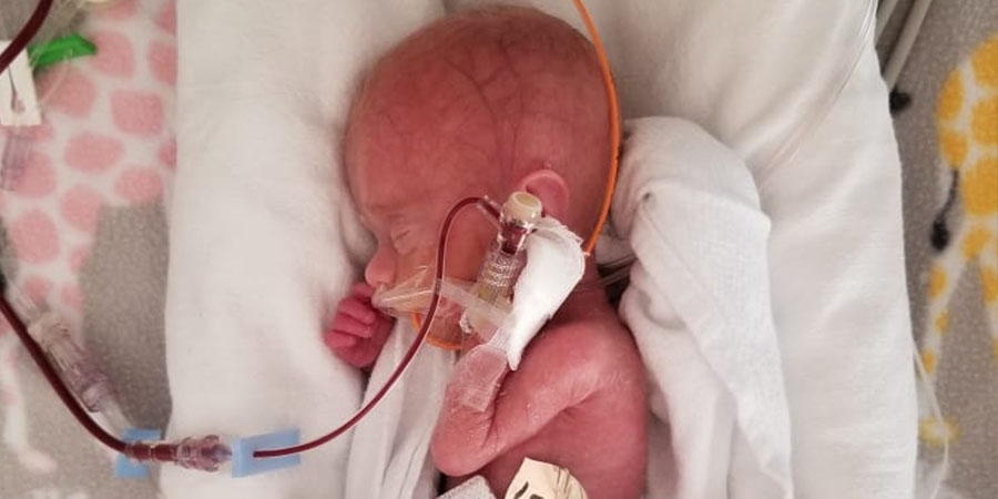 Angels Wear Scrubs and Work in GBMC’s NICU