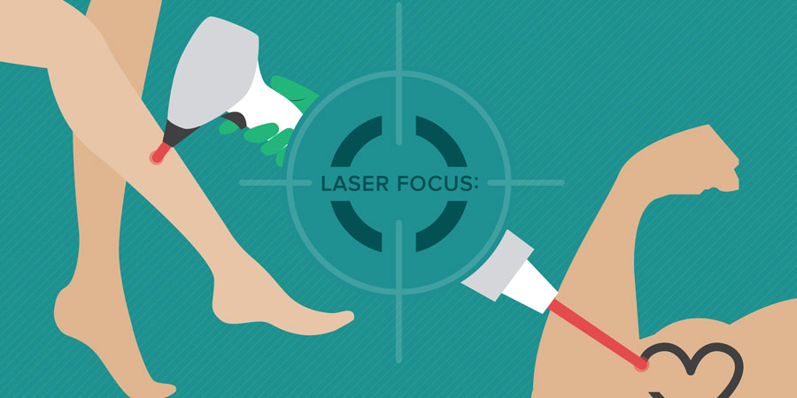 Infographic: 8 Things to Know About Laser Hair and Tattoo Removal