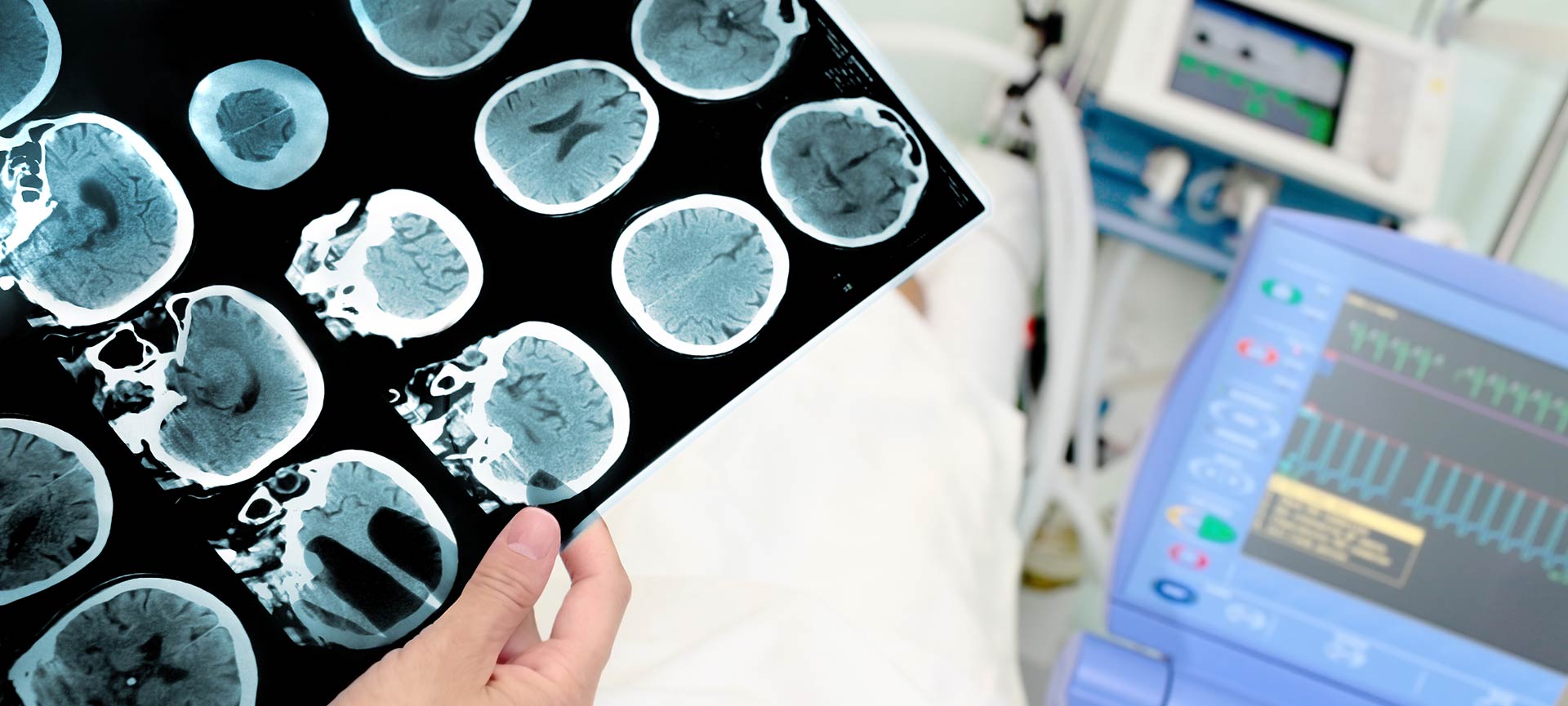 Neurology